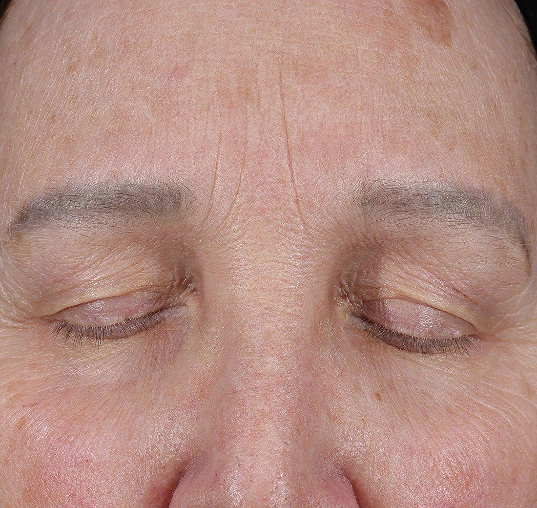 Obagi Medical ELASTIderm Lift & Sculpt Facial Moisturizer – lifts, firms, and hydrates with Bi-Mineral Complex