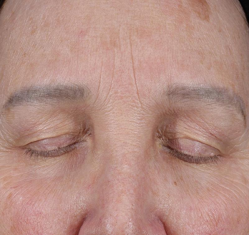 Obagi Medical ELASTIderm Lift & Sculpt Facial Moisturizer – lifts, firms, and hydrates with Bi-Mineral Complex