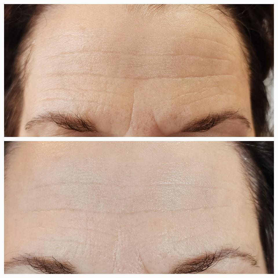 Morganna’s Paracress Organic Oil Restore for fine lines and wrinkles, purest form of Paracress oil, sustainable process, Skin Repair Flower Skincare Morganna’s Paracress Organic Oil Restore for fine lines and wrinkles, purest form of Paracress oil, sustainable process, Skin Repair Flower Skincare