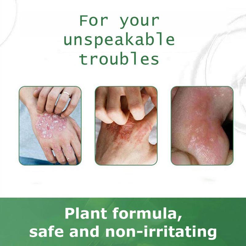Umex Soothing & Relief Cream with Honeysuckle & Peppermint 30g 100% Natural Plant Extracts Gentle for All Ages Fast Acting Relief for Itching Hydrates Dry Sensitive Skin Therapeutic Treatment for Eczema Psoriasis - Wellness