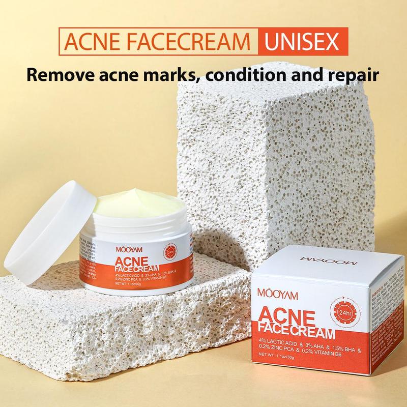 Teen Pimple Acne removal Cream 100g Spot Remover Skin Care Solution
