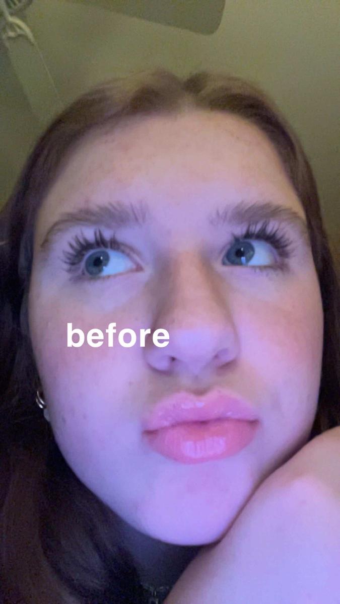 Item: 3 Month Supply (2 mL)