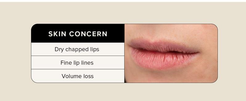 Volulip Plumping Lip Treatment with Hyaluronic Acid & Matrixyl 3000 | Hydrating, Moisturizing & Anti-Aging Lip Balm for Fuller, Softer Lips | 0.5 Fl Oz