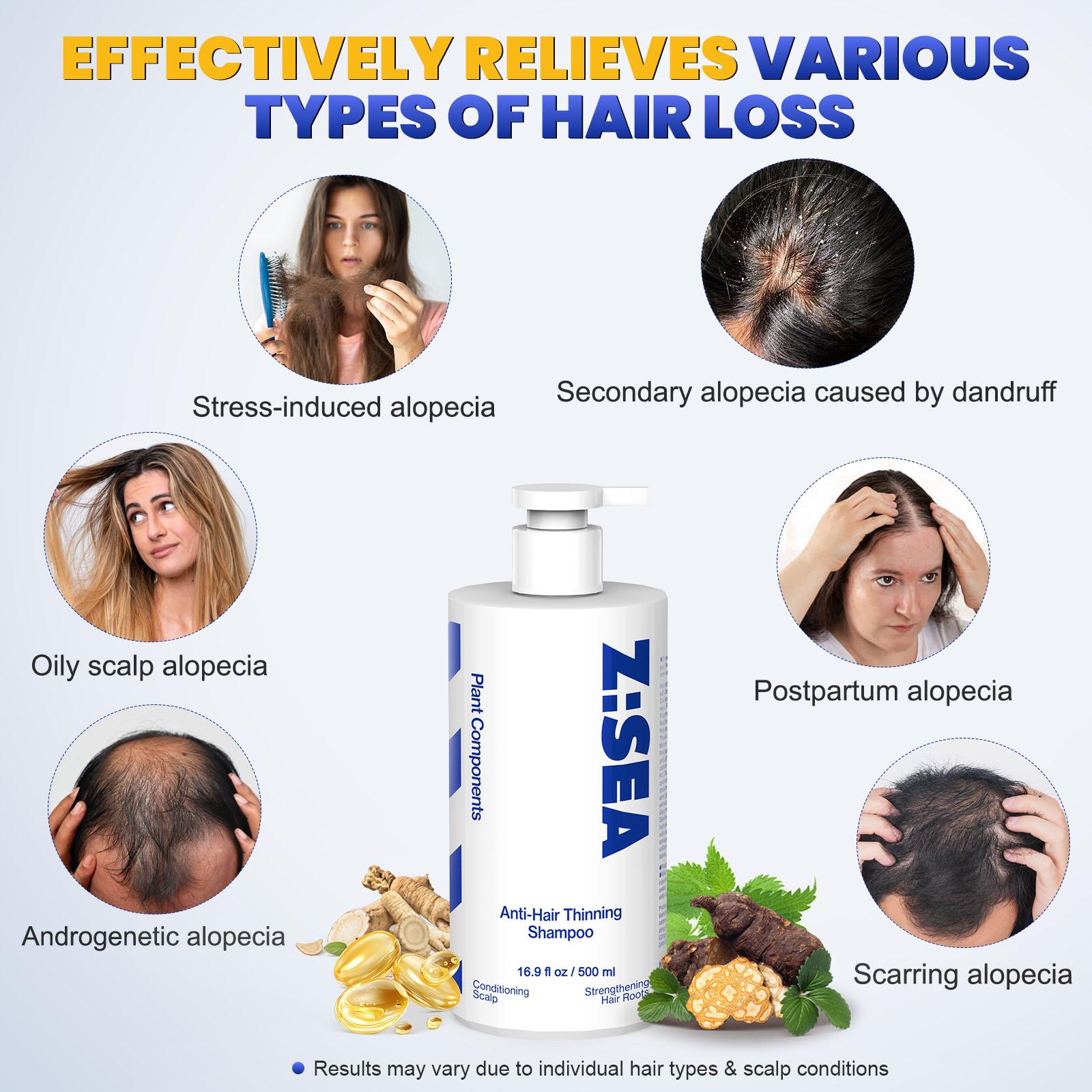 Z:SEA Hair Growth Shampoo - Botanical, Anti-Hair Loss, Strengthens