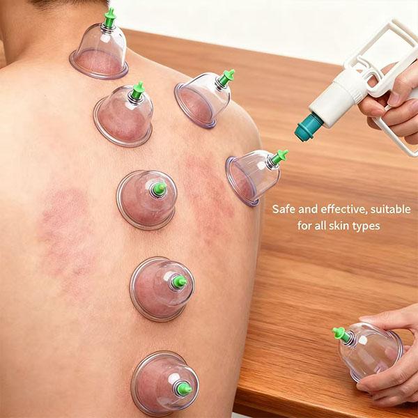 Cupping Set with Pump – 12PCS Vacuum Massage Cups Kit for Muscle Relaxation, Pain Relief & Cellulite Care