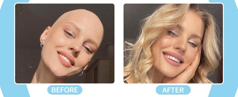 【Valentinesdaygift】36 Counts  Wig Tape for Lace Wigs Double Sided Waterproof Wigs Adhesive, Tape Strips for Lace Front Wig Toupee Sweatproof Invisibletape