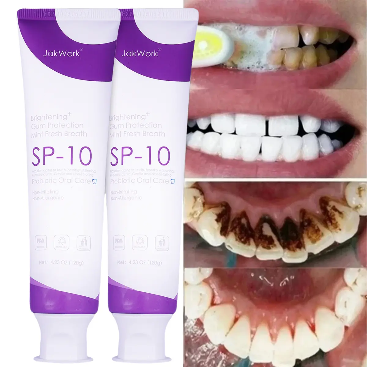 JAKWORK 【2pcs】SP 10 Probiotic Toothpaste Whitening–Improve Oral Health with Dental Probiotic and Probiotics Toothpaste for a Brighter Tooth
