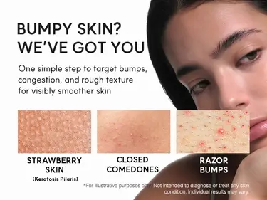 Eraser Shot Glycolic Acid Booster, Daily Clarifying Multi-Acid Formula for Smoother, Clear-Looking Skin | Cares for Sensitive, Breakout-prone Skin | Targets Bumpy Skin (30ml /1.01 fl. oz) | Korean Skincare, K-Beauty