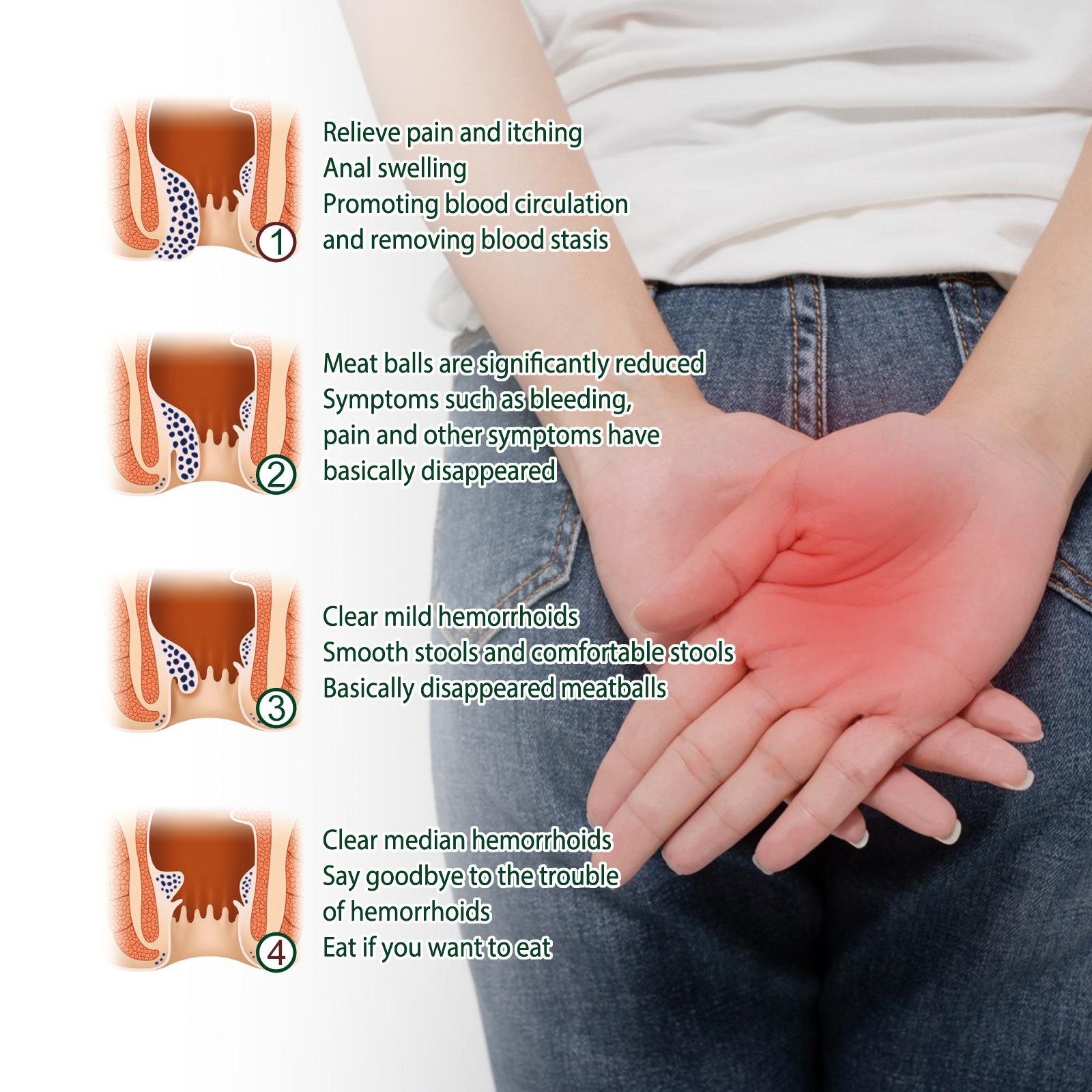 TrueRelief Herbal Instant Pain Relief 50% Hemorrhoids Cream for Men & Women - 20g Tube - Maximum Strength Formula for Anti-Itch Burning & Discomfort Treatment - Soothing Body Care Ointment extension tube