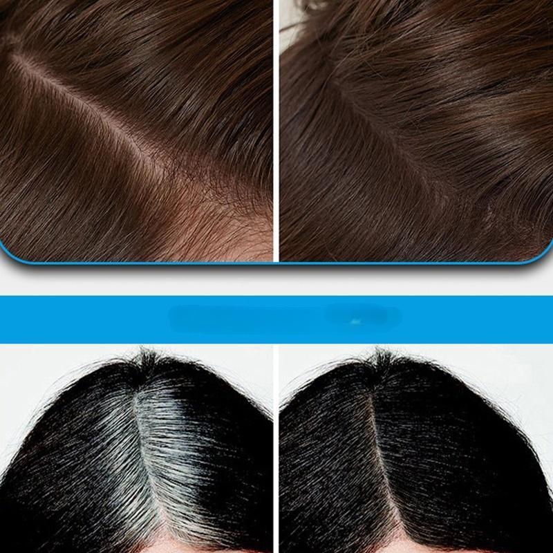 Multi-Functional Instant Concealer Hairline Powder - 10g Compact with Mirror & Sponge Applicator for Seamless Natural Finish & Waterproof Coverage#ThinningHairConcealer #GrayRootCoverUp #PostpartumHairLossFix #MenHairlineFiller #OnTheGoBeauty