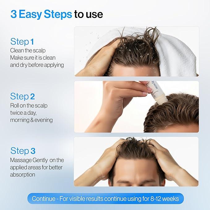 2xBe Bodywise Rosemary Hair Growth Serum 25ml – 3% Rosemary, 3% Redensyl & 2% Again | DHT-blocking scalp serum that promotes oxygen flow and reduces hair loss | Paraben/Sulfate-free | For women and men