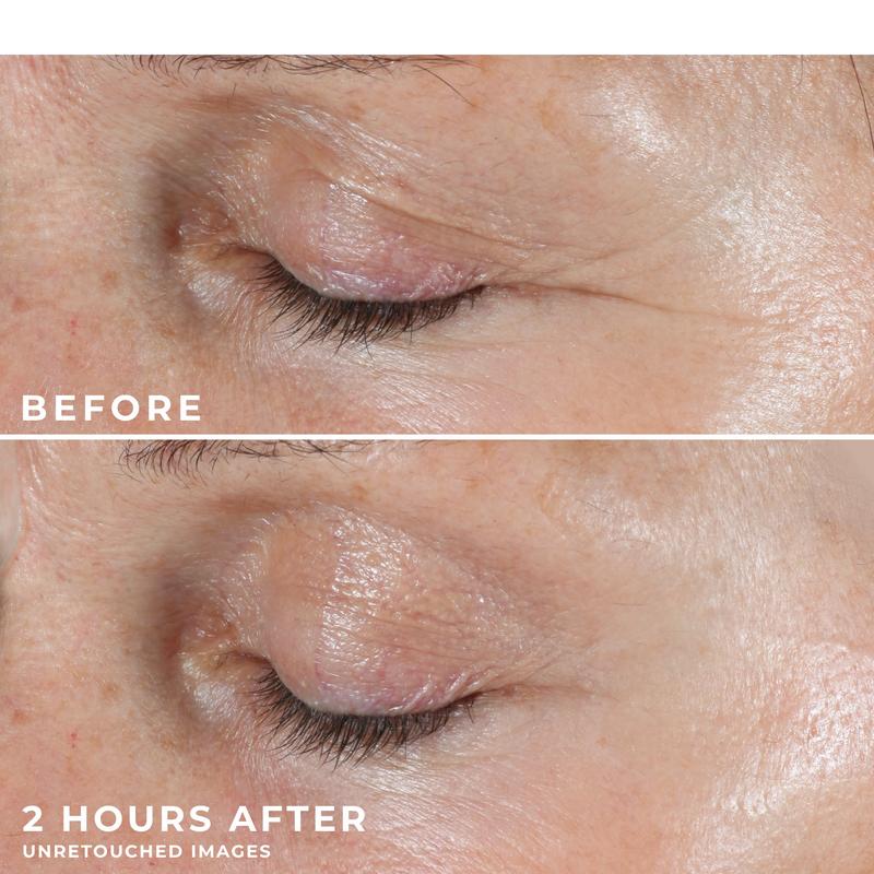 [RoC Skincare] RETINOL CORREXION Deep Wrinkle Targeted Patches