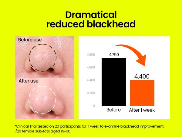 [beplain Official] Korea's No.1 Mung Bean Cleansing Oil 200ml | Lightweight Hydrating Powerful Gentle All Skin Types Makeup Remover Moisturizing Moisture Cosmetic Moisturize Korean Moisturizer