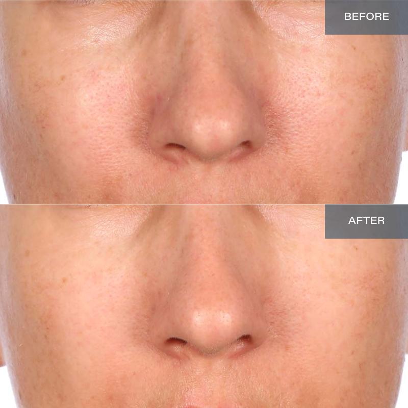 SKINN Cosmetics: Mantle Milk Skin Repair 100 Hours of Hydration - Moisture-Supporting Serum for Enhanced Hydration and Barrier Care Moisturizer Milky