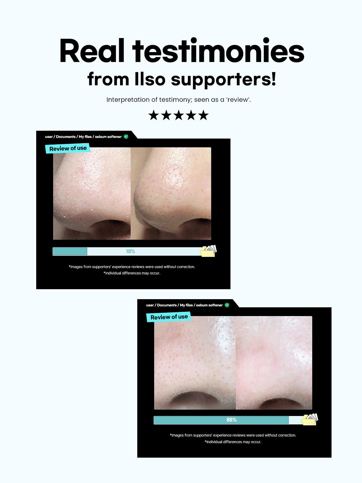 ILSO Super Melting Sebum Softener 5.29 fl oz with 40 Skin Wrap Cotton Pads Included for Deep Clean Master Makeup Remover Towelettes Facial Cleansing Wipes Daily,Melt Blackheads and Sebum