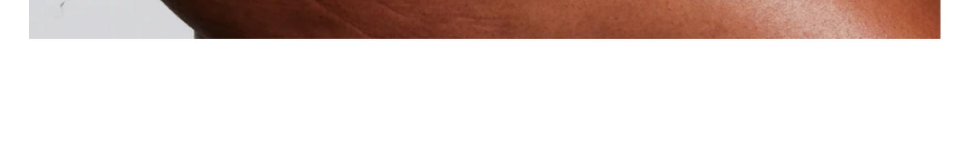 REMEDY for Body Bumps - KP Exfoliating Body Moisturizer