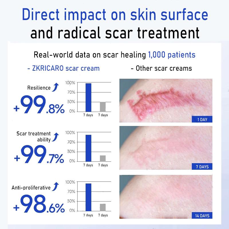 Scar Removal Cream & Gel for Effective Scarring Reduction - Fades Surgical & Acne Scars, Promotes Cell Regeneration, Lightweight Texture, Suitable for All Skin Types