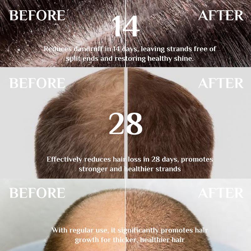 BaliAga Kemiri Oil Hair Care Essential Oil From Bali For Hair Strengthen Hair/Nourish Scalp/Split End Care Plant Comfort Haircare Organic