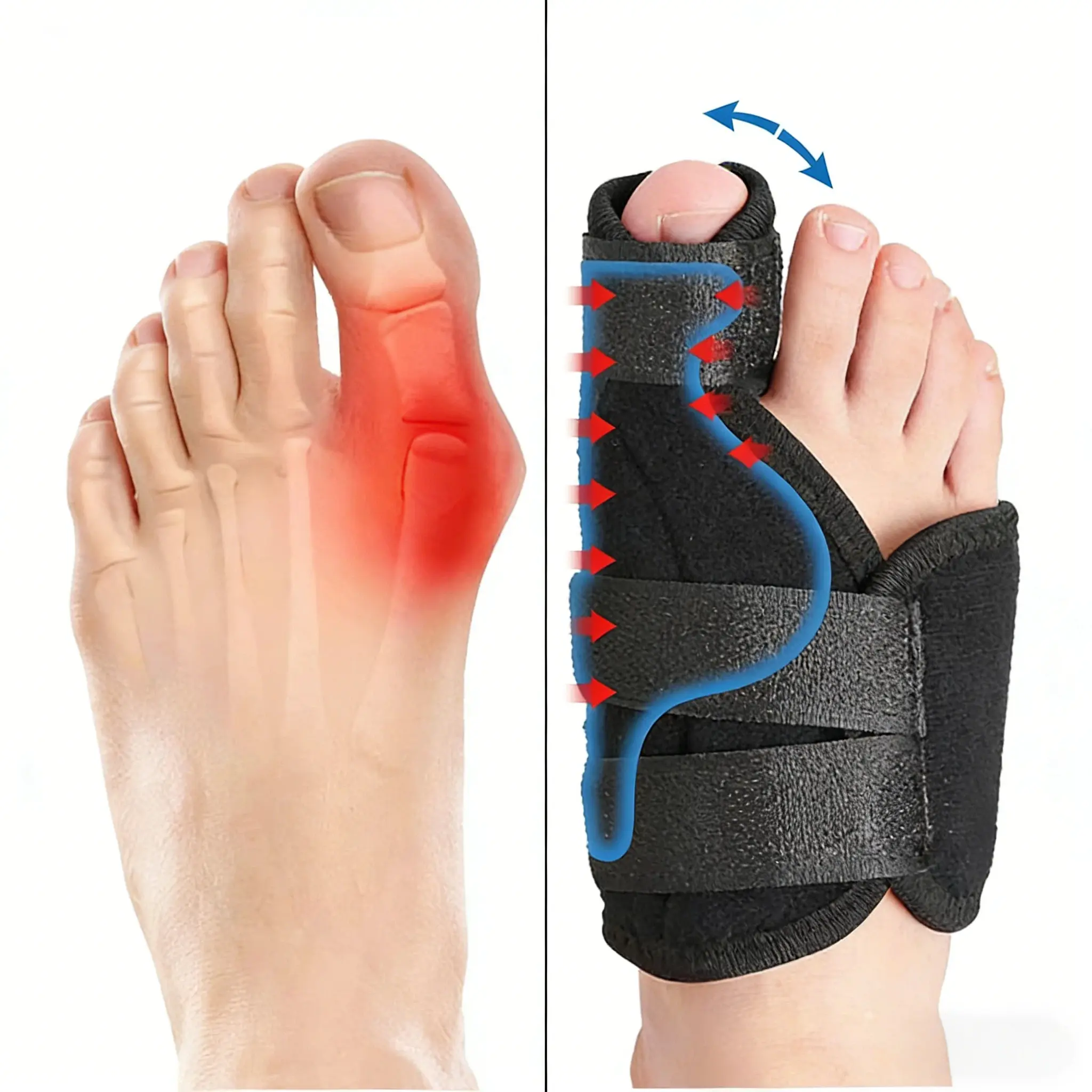 Adjustable Hallux Valgus Bunion Corrector For Men And Women, Orthopedic Big Toe Splint, Effective Foot Pain Relief, Flexible Toe Separator, Hammer Toe Straightener, Comfortable Day Night Foot Support Brace
