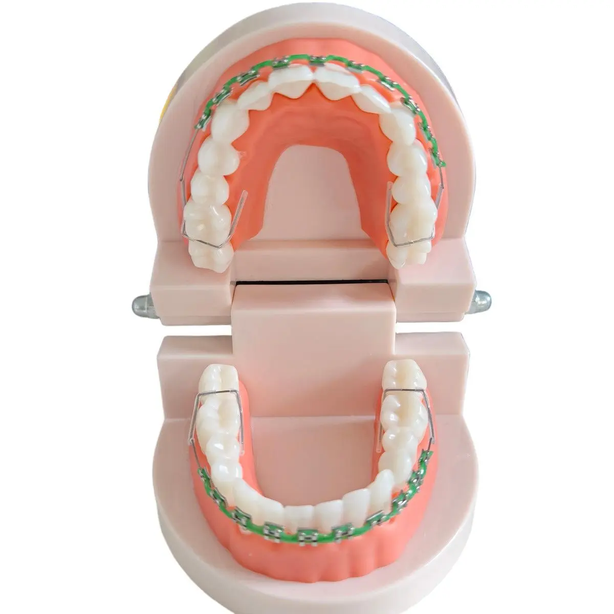 Fashionable braces decoration, colorful braces, a full range of colors, dental decorative accessories, stylish braces