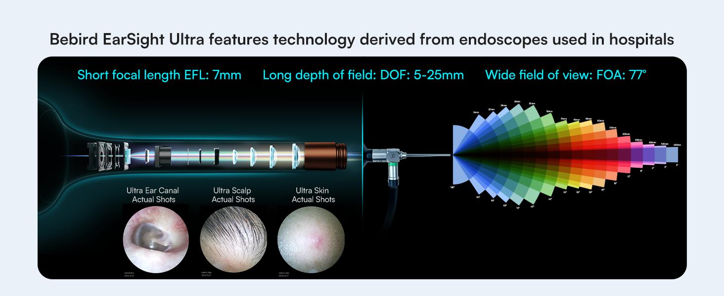【Theatrical-Grade】Bebird Earsight Ultra Ear Wax Removal Tool , Ear Cleaner with Flexible Ear Camera Otoscope, Painless Visual Ear Pick Tweezers, Visual Scope Earwax Cleaning Dropper, Ear Cleaning Kit for Family