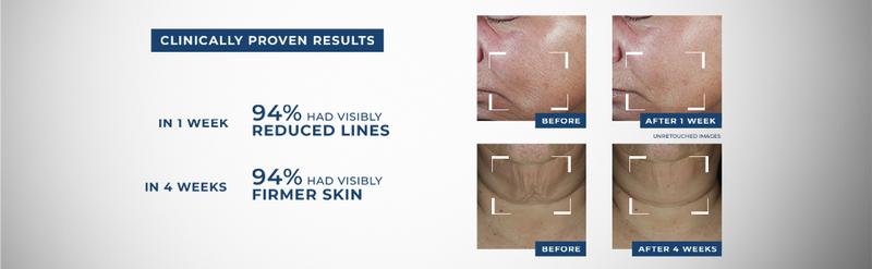 [RoC Skincare] DERM CORREXION Firming Serum Stick