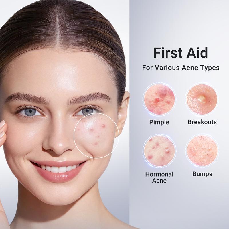 Dr.Leo Drying Lotion Plus | Visibly Shrinks Pimples in 24 Hours & Helps Fade Acne Marks in 7 Days | With 1.8% Encapsulated Salicylic Acid, 4% Niacinamide & 10% Sulfur  (20ml)