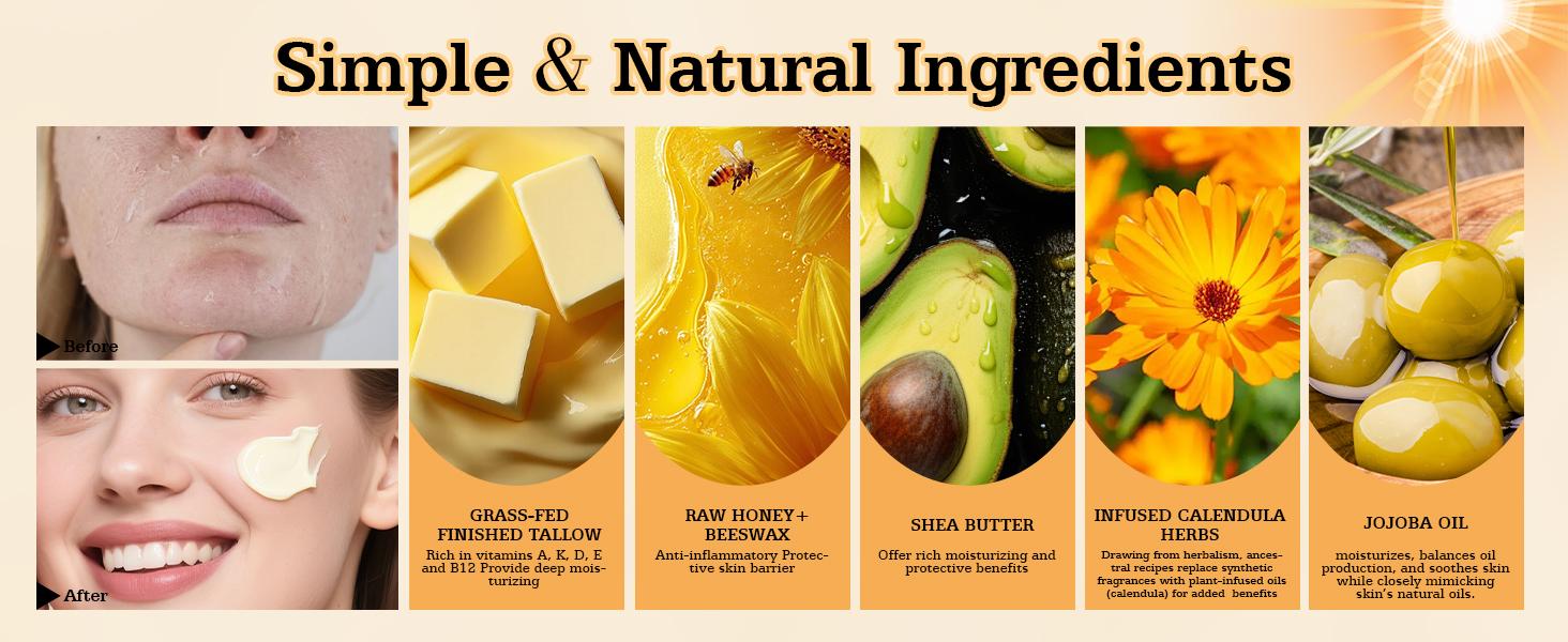 Whipped Organic Grass-Fed Beef Tallow Honey Balm – Handmade Moisturizer with Shea, Calendula & Jojoba for Soft, Healthy Skin