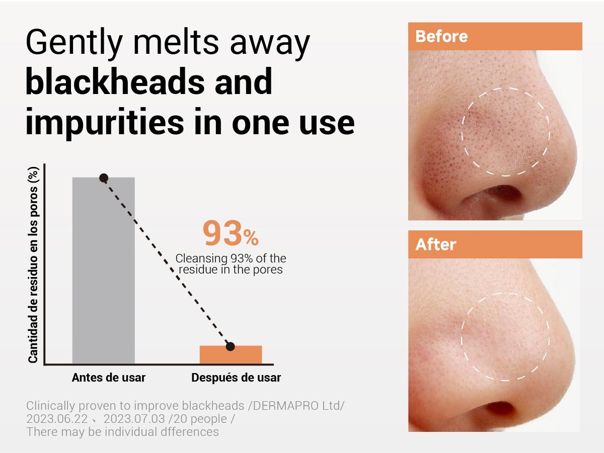 【Flash Sale】 Heimish All Clean Balm Mandarin (4.0 fl.oz / 120ml) | Balm-to-Oil Facial Cleanser for Makeup Removal, Pore Care & Blackhead Care, Springtok Herbal