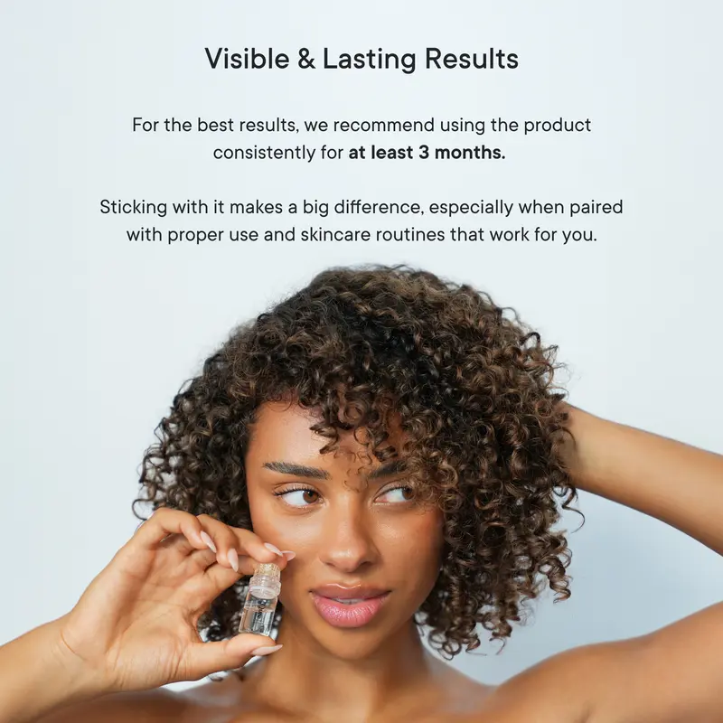 Qure Micro-Infusion System: Facial Serum for All Skin Types - 2 Months Mixed (For Wrinkles + Dark Spots) 6