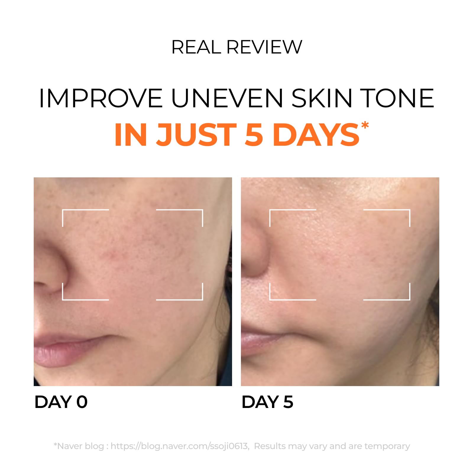 DOMINAS Hyper P-Toning Serum with Niacinamide & Tranexamic Acid for Dark Spot Reduction 30ml Korean Skin Repair