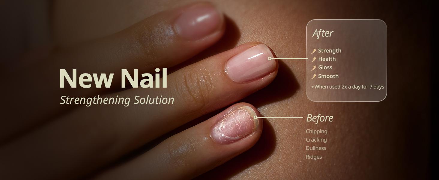 BTArtboxnails Naillush Nail Growth Oil - Nail Strengthener & Growth Repair Damaged Nails, Strengthen Weak & Thin Nails, Extra Strong Nail Growth Treatment, Long Lasting Nail Hardener, 15ml