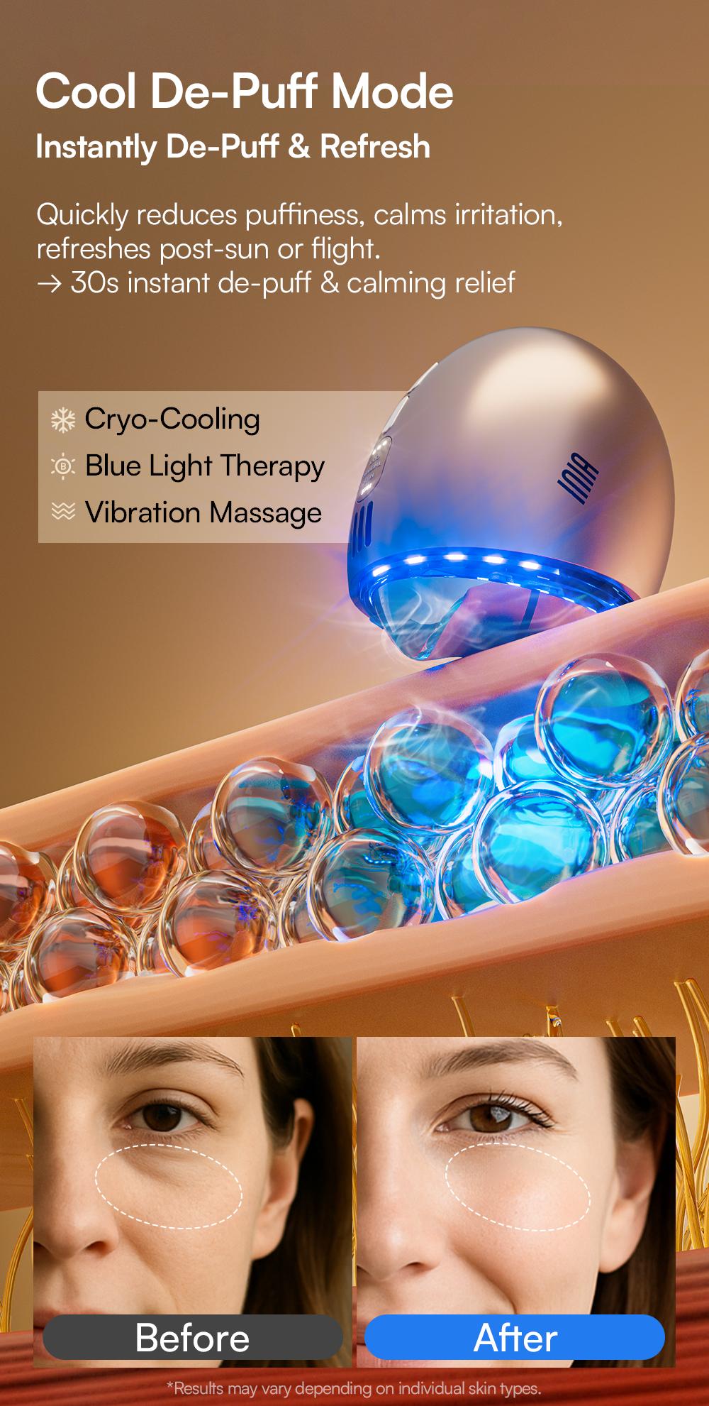 INIA GLACE Microcurrent Lymphatic Drainage Beauty Device | EMS Microcurrent-Activated Deep Drainage with Red & Blue Light, Thermal & Cryo Therapy for Instant De-Puff, Snatched Lift, Face & Neck Sculpting, Best Valentine's Day Gift for Her