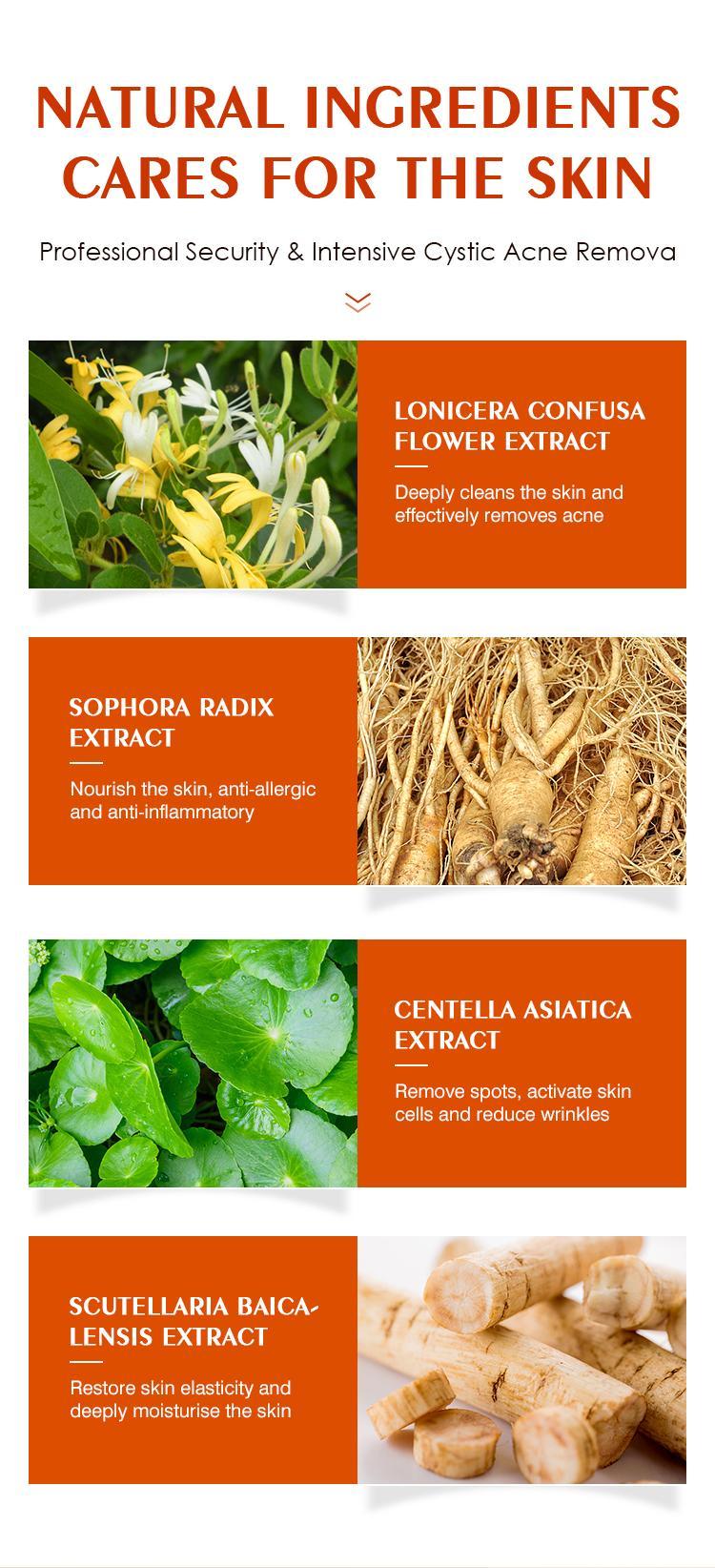 Teen Pimple Acne removal Cream 100g Spot Remover Skin Care Solution