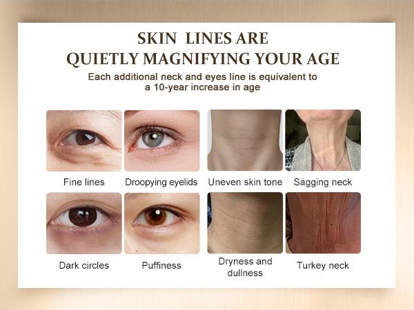 YCZ Neck-Eye Care Tightening & Revitalizing Set - Smooth of Fine Lines, Eye & Neck Treatment, Moisturizer for Enhanced Skin Health - Hydrating Gentle Skincare YCZ Neck-Eye Care Tightening & Revitalizing Set - Smooth of Fine Lines, Eye & Neck Treatment, Moisturizer for Enhanced Skin Health - Hydrating Gentle Skincare