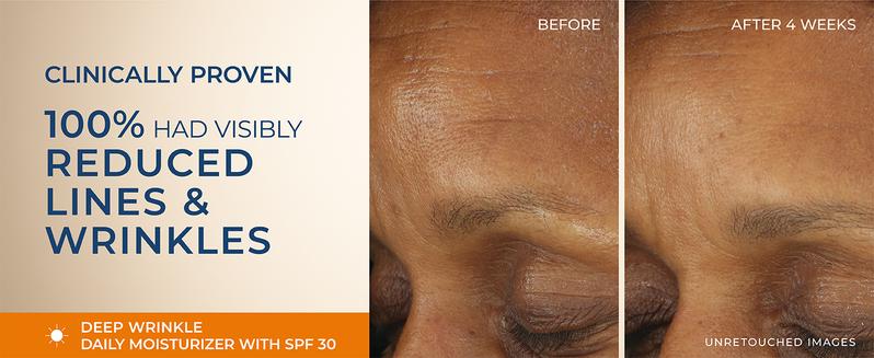 [RoC Skincare] RETINOL CORREXION Deep Wrinkle Daily Moisturizer SPF 30