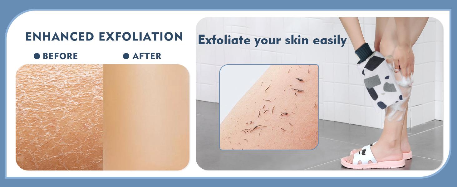 Exfoliating Mitts, Exfoliator Gloves Visibly Lift Away Dead Skin, Great for Deap Body Cleaning, Keratosis Pilaris Scrub Bathroom Essentials