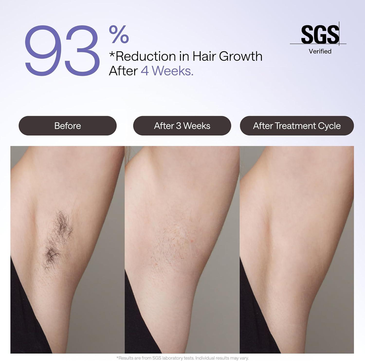 【2026 New Arrival】Ulike Air 4 IPL Hair Removal Device with Increased Power, More Convenient Operation, Ice-Cooling Contact Technology & Skin Sensor. Suitable for Women and Men. Achieves up to 90% Hair Reduction in 4 Weeks. Comfortable and Effective