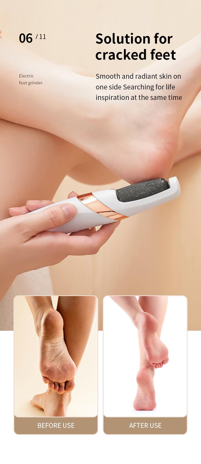 Electric Feet Callus Remover,Portable Electronic Foot File Pedicure Tools,Waterproof Foot Scrubber File,Pedi Foot Care for Dead,Hard Cracked Dry Skin Manicure Nail Nail Care Cutics Nail Art
