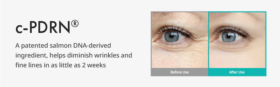 REJURAN Intensive Eye Cream, c-PDRN - Fast-Acting Eye Treatment for Wrinkles, Lifting, and Dark Circles. Instant Hydration and Visible Revitalization. Korean Skin Care (0.67 fl oz)