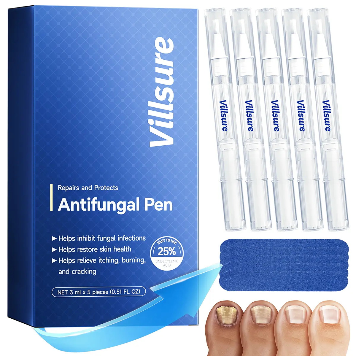 5-Pack Antifungal Pen for Nail Fungus | Portable Fungus Fighter with Precision Brush & 25% Undecylenic Acid | Treats Discoloration, Peeling & Thick Nails