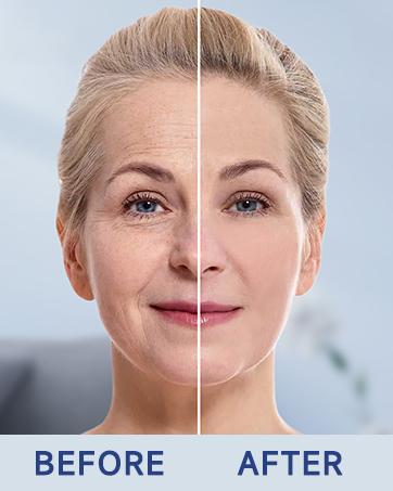 【Limited-time flash sale】Ragkun Retinol Collagen Cream - Advanced Anti-Wrinkle Formula with Vitamin A B C E & Hyaluronic Acid for Firming & Moisturizing - 1.7 fl oz