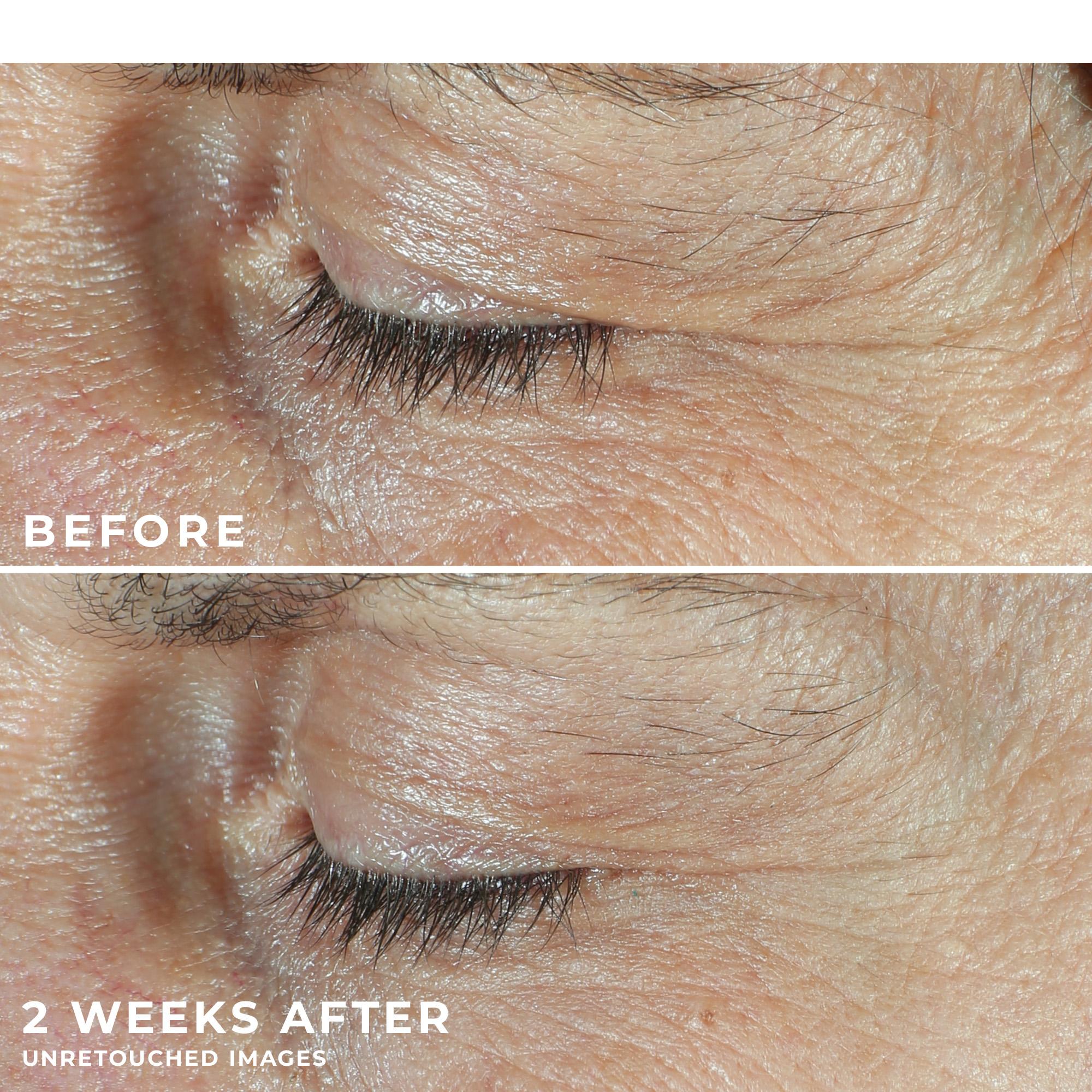 [RoC Skincare] DERM CORREXION Dual Eye Cream