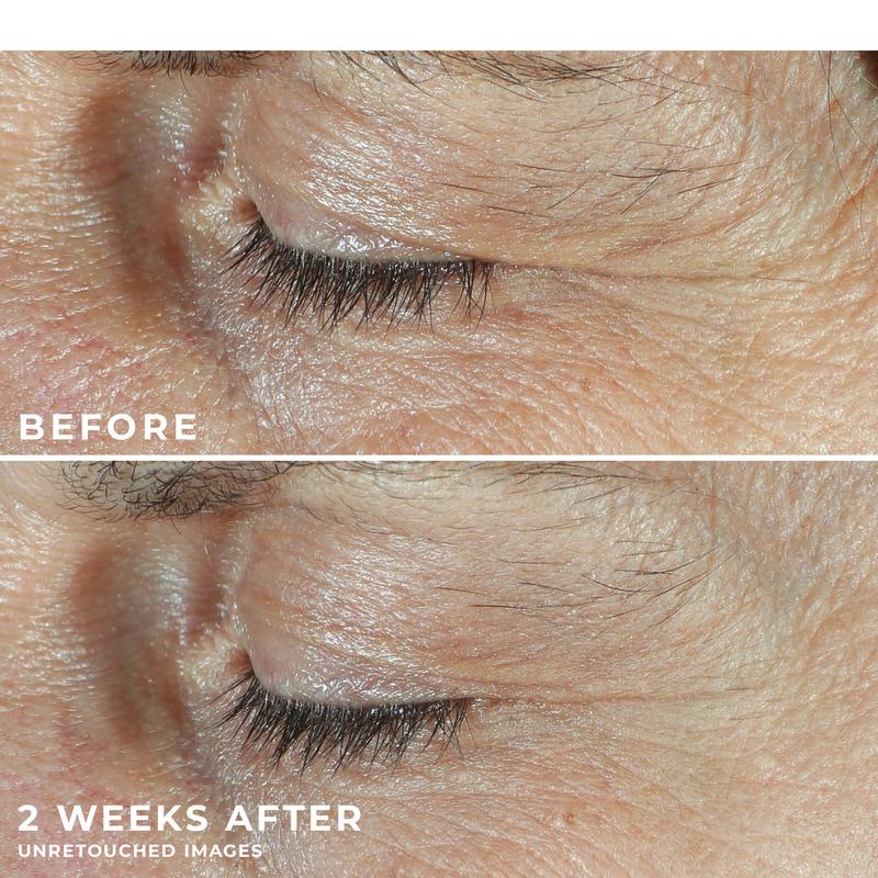 [RoC Skincare] DERM CORREXION Dual Eye Cream