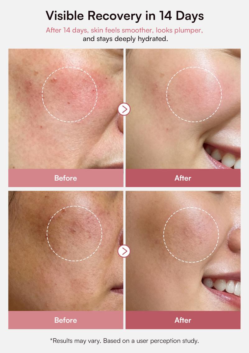 INIA PDRN + Peptide Repair Cream– Intensive Repair, Firm & Hydrate for Sensitive Skin with Salmon DNA, 5% Niacinamide & Collagen, Fresh PDRN Capsules for Maximum Repair, Layerable with Sunscreen & Makeup