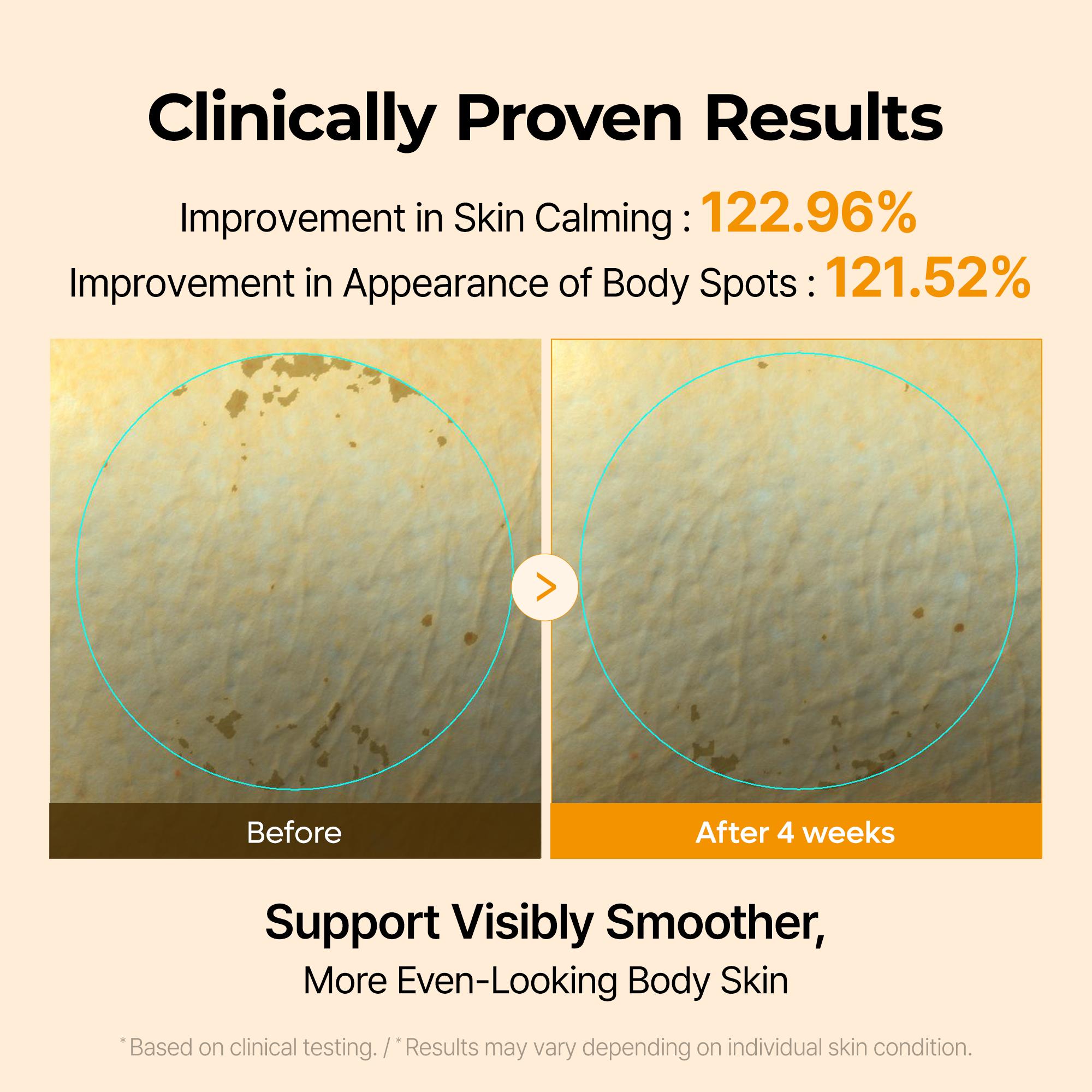 [Dr.melaxin Official] Kojic Acid Turmeric Capsule Body Cream 200ml for Body Dark Spot & Uneven Tone Care