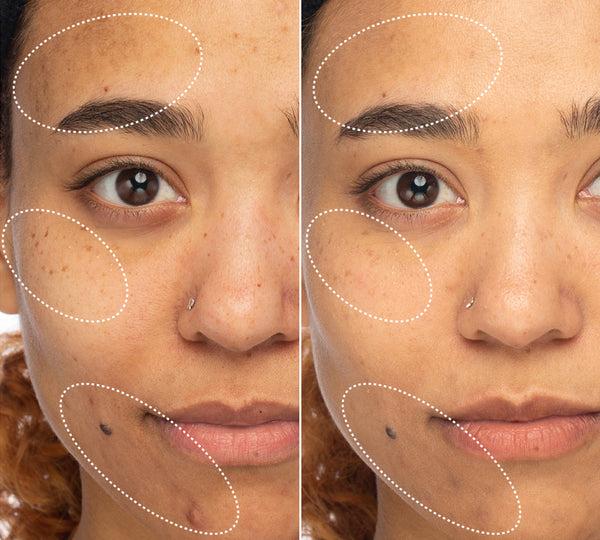 INNBEAUTY PROJECT Green Machine Serum - Dark Spot Corrector with Vitamin C, Azelaic Acid, & 15 Superfoods for Radiant Skin INNBEAUTY PROJECT Green Machine Serum - Dark Spot Corrector with Vitamin C, Azelaic Acid, & 15 Superfoods for Radiant Skin