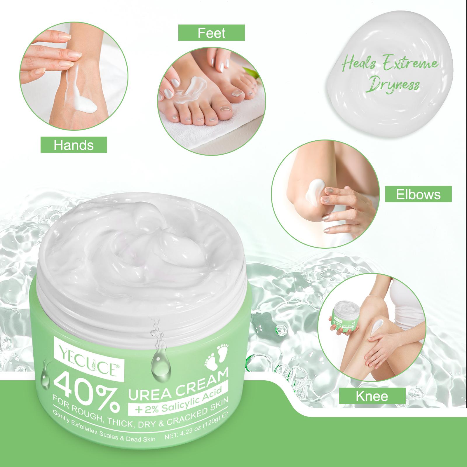 Urea Cream 40% plus Salicylic Acid 2% - Maximum Strength for Dry, Cracked Feet and Hands - Moisturizes and Softens  Hydrating Exfoliating Skin Friendly Moisturizer Hyaluronic Moisturizing Moisture Hydrate Nails