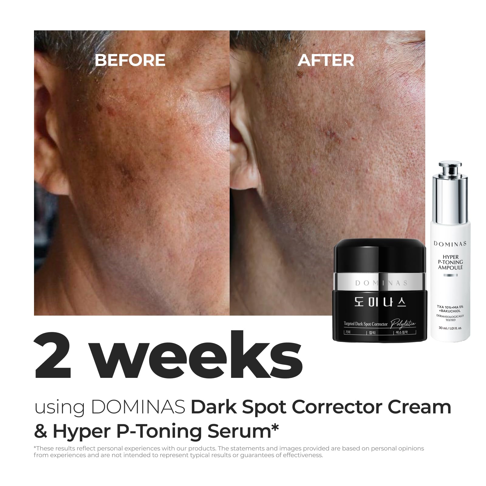 DOMINAS Hyper P-Toning Serum with Niacinamide & Tranexamic Acid for Dark Spot Reduction 30ml Korean Skin Repair