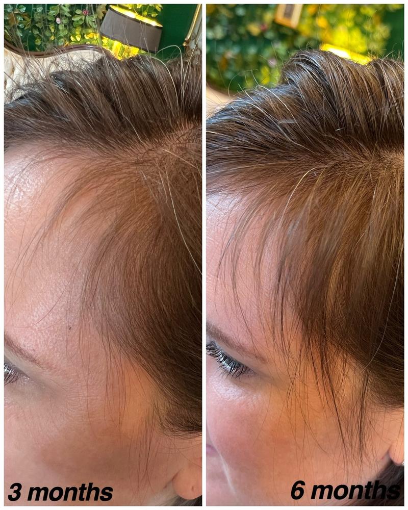 Be in Love Growth Root Spray for Haircare - Matte Formula, All Natural Ingredients, Cruelty Free-Vegan, Plant Based, Science Backed - Comfort